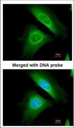 Optineurin Antibody in Immunocytochemistry (ICC/IF)