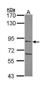 APEH Polyclonal Antibody