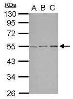 STK38L Polyclonal Antibody