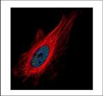 ZNF449 Antibody in Immunocytochemistry (ICC/IF)