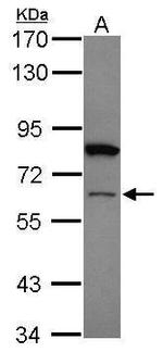 ZNF449 Antibody in Western Blot (WB)