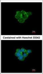 CHRNA3 Polyclonal Antibody