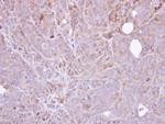 STS Polyclonal Antibody