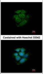 JNK2 Polyclonal Antibody