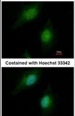 SREBP2 Antibody in Immunocytochemistry (ICC/IF)