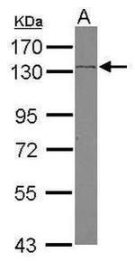 SREBP2 Antibody in Western Blot (WB)