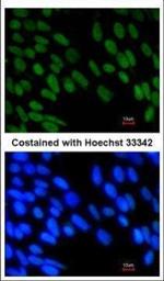 ZMYM2 Antibody in Immunocytochemistry (ICC/IF)