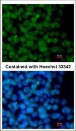 ZMYM2 Antibody in Immunocytochemistry (ICC/IF)