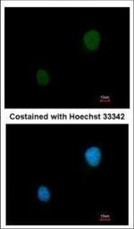 PRKAR2B Polyclonal Antibody