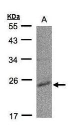 CMPK1 Antibody in Western Blot (WB)