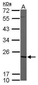 CMPK1 Antibody in Western Blot (WB)