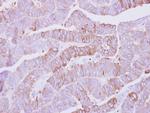 CSNK1A1L Antibody in Immunohistochemistry (Paraffin) (IHC (P))