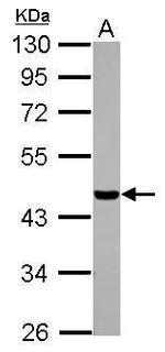 CSNK1A1L Antibody in Western Blot (WB)