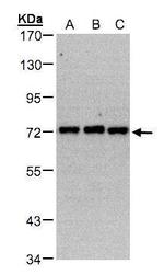 PIP5K1C Antibody in Western Blot (WB)