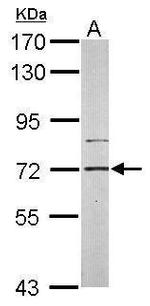 PIP5K1C Antibody in Western Blot (WB)