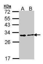 FKBP25 Polyclonal Antibody
