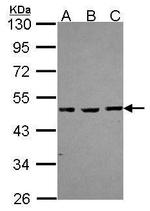 MBD2 Polyclonal Antibody