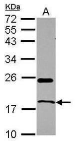 RNase1 Antibody in Western Blot (WB)