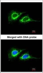 Cytokeratin 18 Antibody in Immunocytochemistry (ICC/IF)