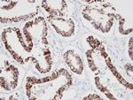 Cytokeratin 18 Antibody in Immunohistochemistry (Paraffin) (IHC (P))