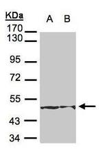 Cytokeratin 18 Antibody in Western Blot (WB)