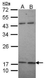KCNMB1 Polyclonal Antibody