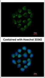 Cathepsin O Polyclonal Antibody