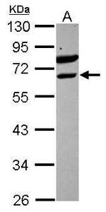 ETV6 Polyclonal Antibody