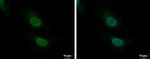 CNOT8 Polyclonal Antibody