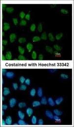 ZNF281 Polyclonal Antibody