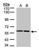 SRPR Antibody in Western Blot (WB)