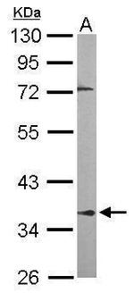 PPP2R4 Polyclonal Antibody