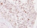 NPAS2 Antibody in Immunohistochemistry (Paraffin) (IHC (P))