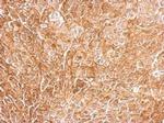 CHL1 Antibody in Immunohistochemistry (Paraffin) (IHC (P))