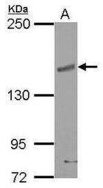 CHL1 Antibody in Western Blot (WB)