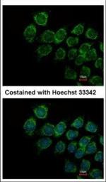 IFNAR2 Polyclonal Antibody