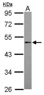PRAK Polyclonal Antibody
