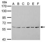 ASC1 Antibody in Western Blot (WB)