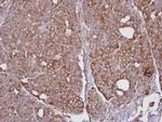 SEC31A Antibody in Immunohistochemistry (Paraffin) (IHC (P))