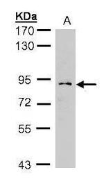 GCS1 Polyclonal Antibody