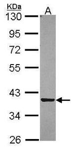 PIG3 Polyclonal Antibody