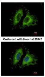 GIT1 Polyclonal Antibody