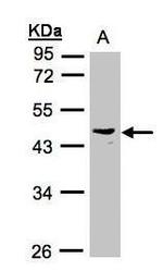 PSG6 Polyclonal Antibody