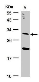 UROS Polyclonal Antibody