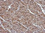 RABGGTB Antibody in Immunohistochemistry (Paraffin) (IHC (P))