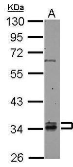 RABGGTB Antibody in Western Blot (WB)