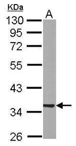 RABGGTB Antibody in Western Blot (WB)