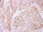ETNK1 Polyclonal Antibody