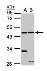 ETNK1 Antibody in Western Blot (WB)