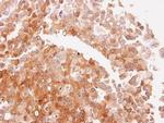 NQO2 Polyclonal Antibody